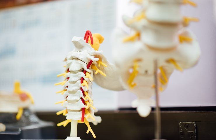 tumore spina dorsale