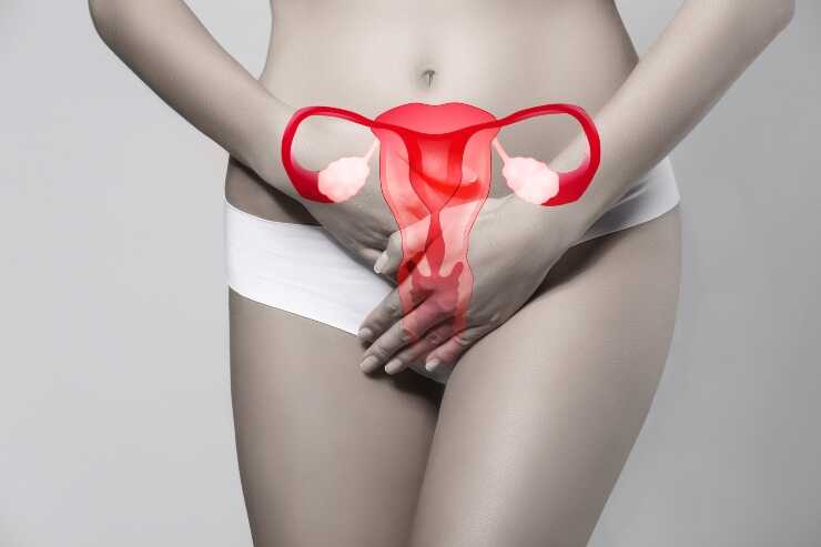 Cancro dell'endometrio