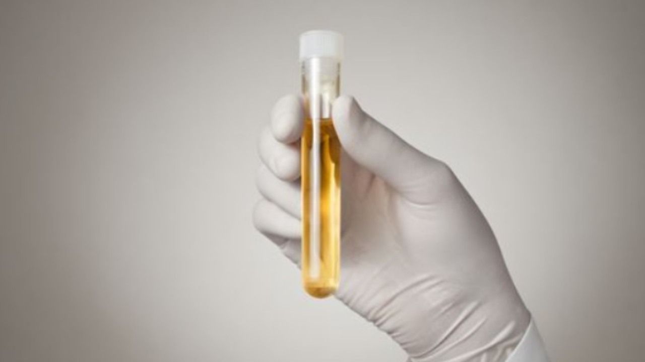cancro prostata