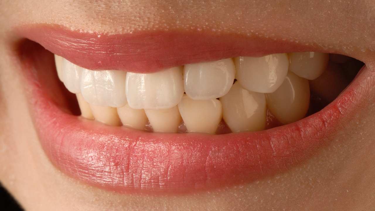 togliere giallo denti