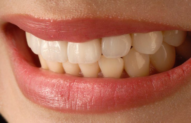 denti bianchi 
