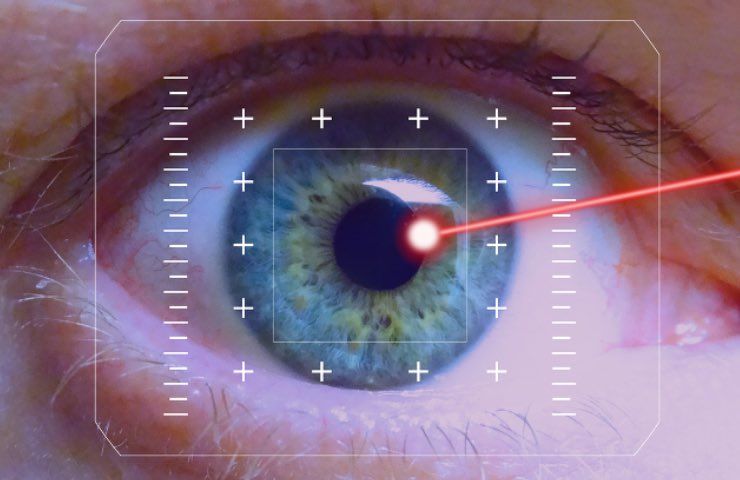 occhio laser