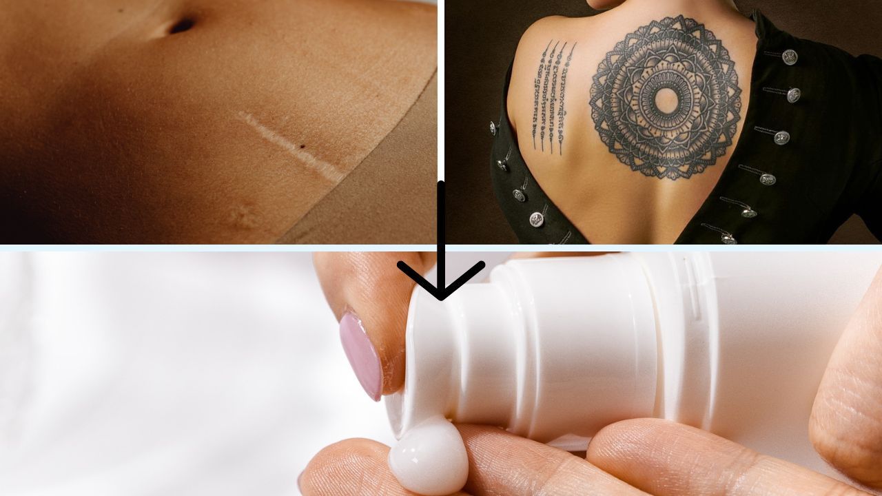 protezione solare tatuaggi cicatrici