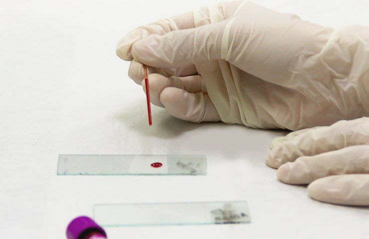 analizzare il sangue salute 