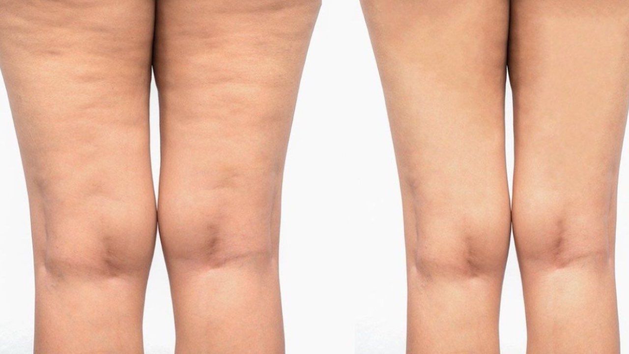 nascondere cellulite trucco