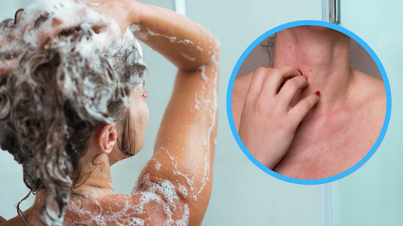 Allergia al bagnoschiuma