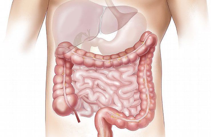 prevenzione cancro colon