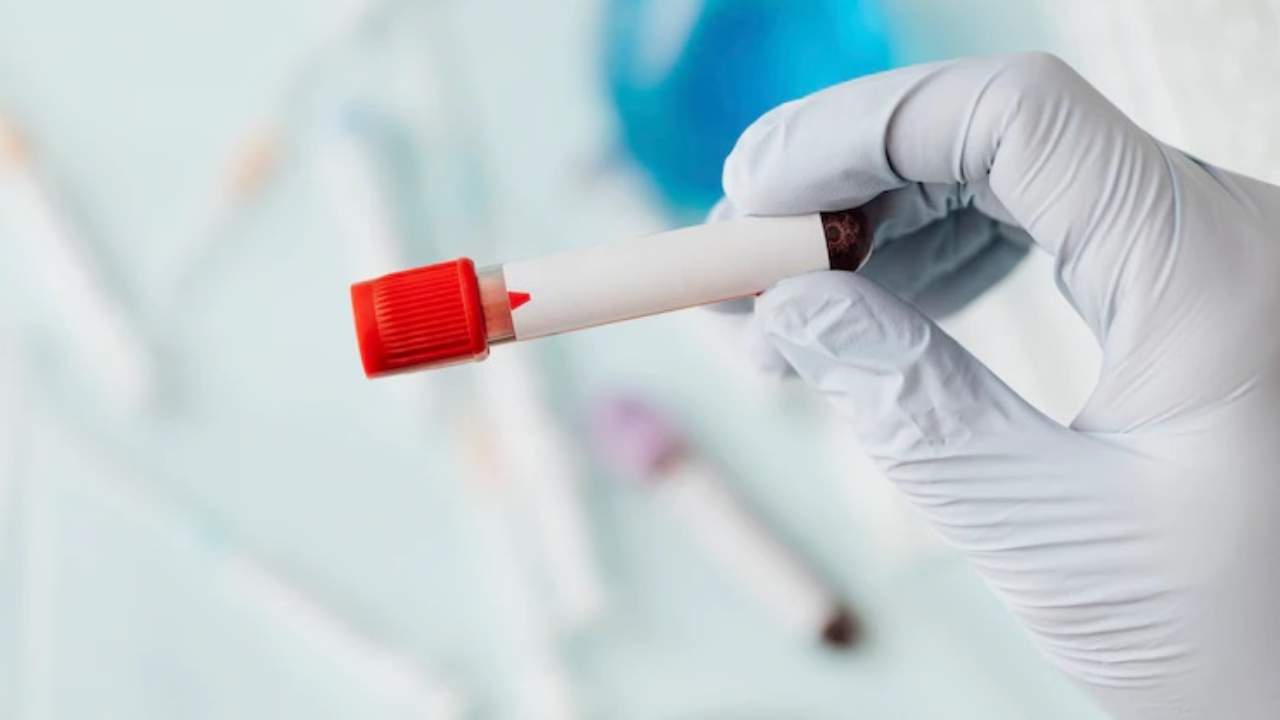 test allergici analisi del sangue quanto costano