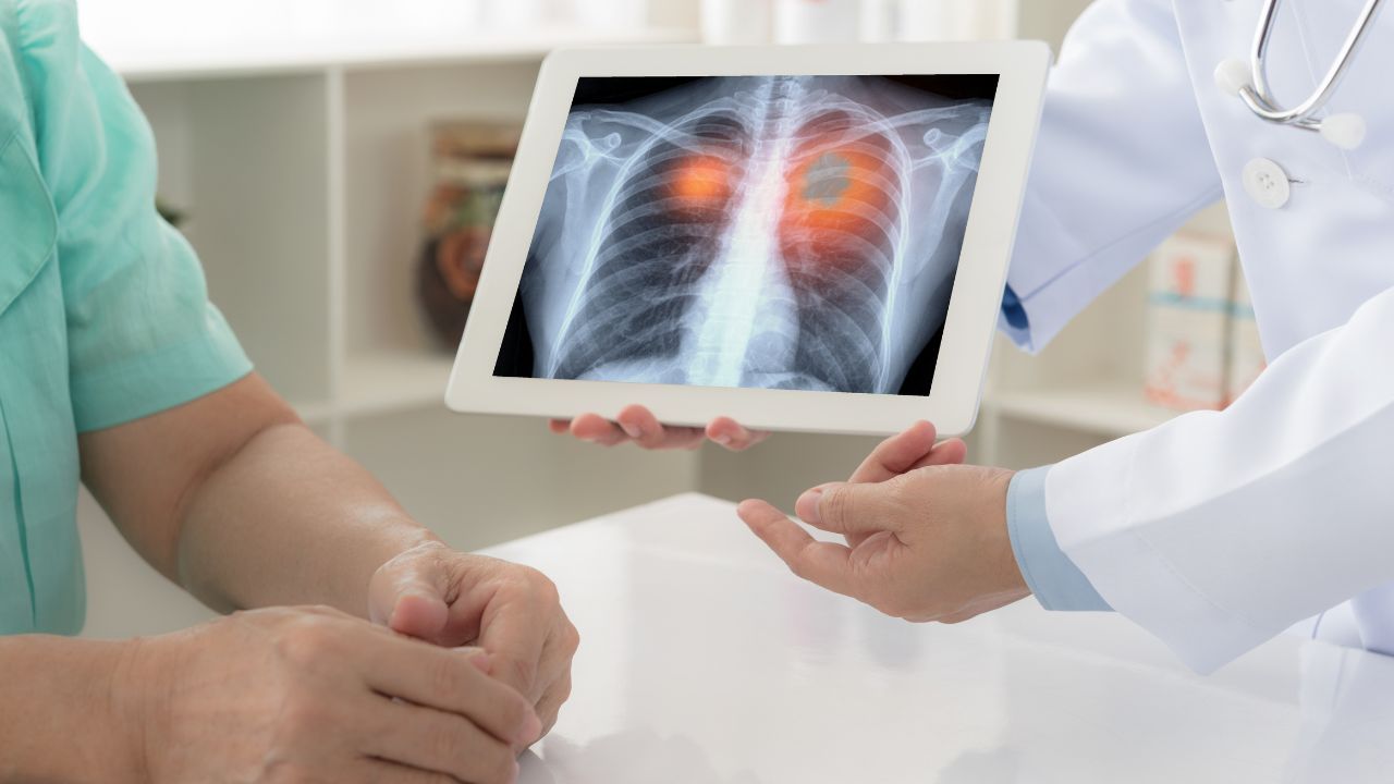 Diagnosticare il cancro ai polmoni