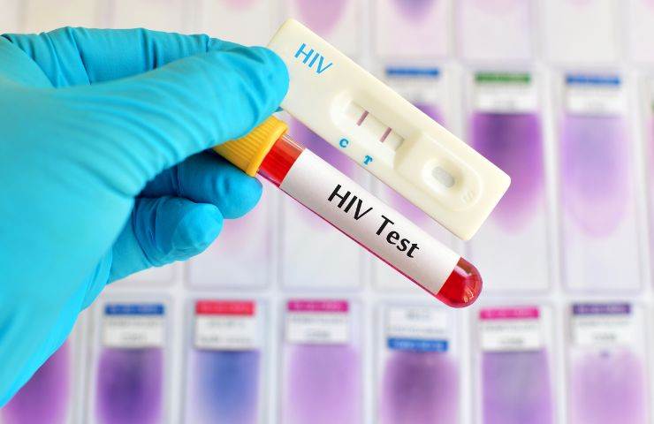 Un test per l'AIDS ed altri strumenti