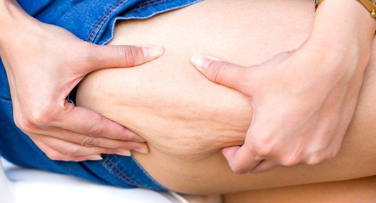 Cellulite addio con fanghi