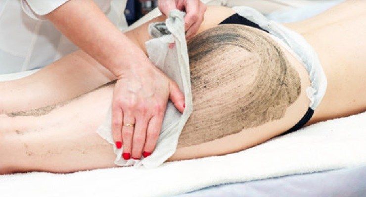 Eliminare cellulite con fanghi