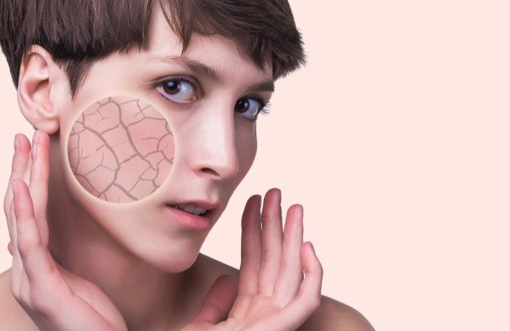Primo piano viso donna pelle secca