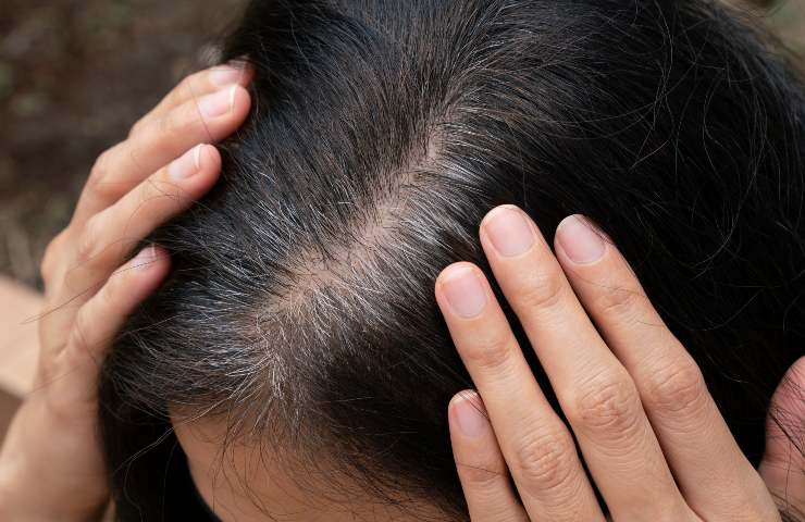 Ricrescita capelli bianchi donna