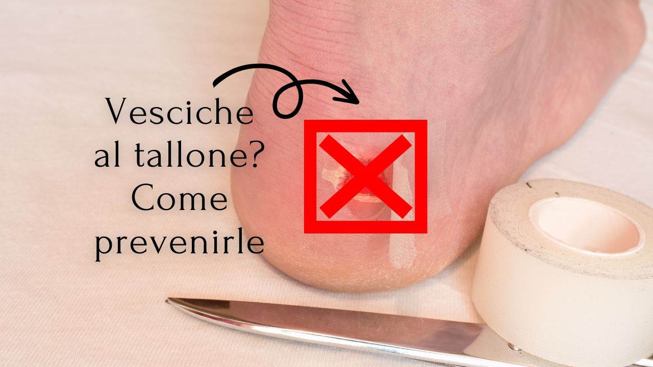 prevenire vesciche tallone