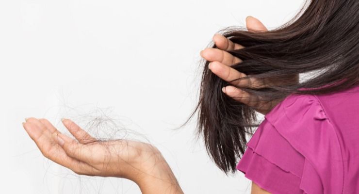 come contrastare alopecia femminile