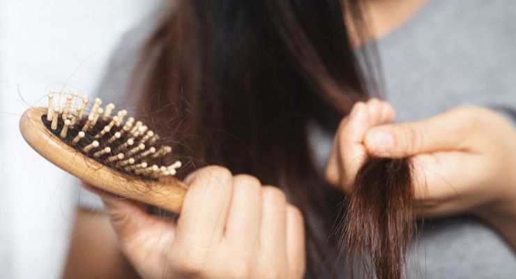 Rimedi contro diradamento dei capelli