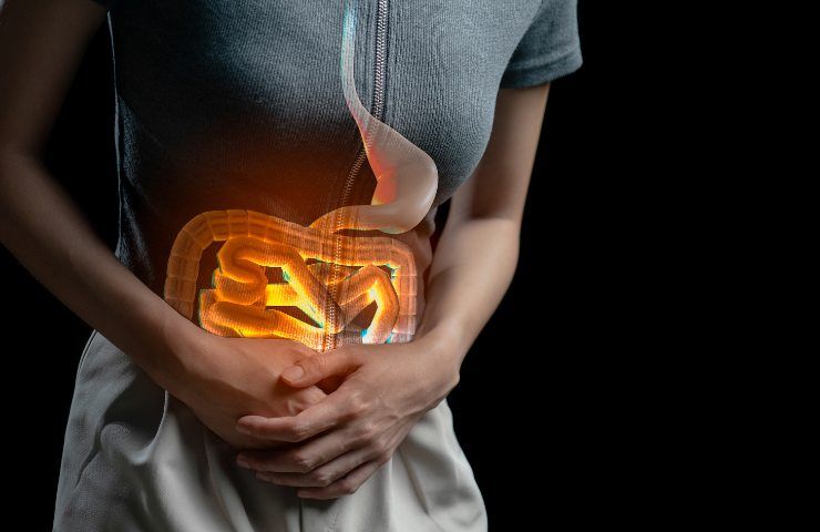 Intestino irritato con stitichezza cronica