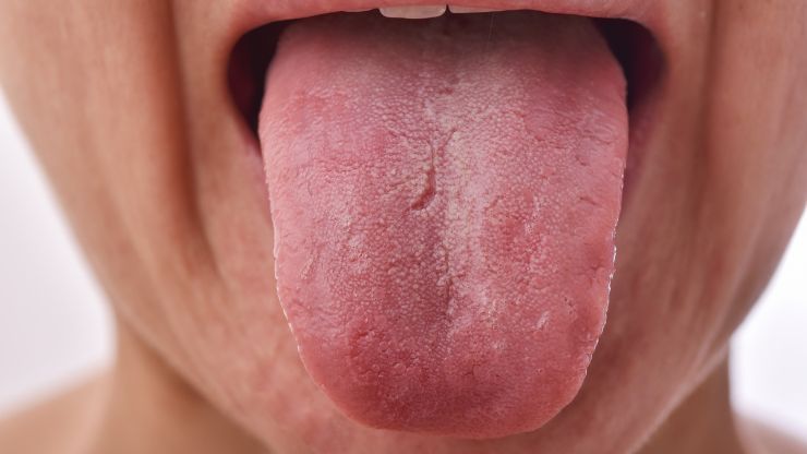 sintomi legati lingua