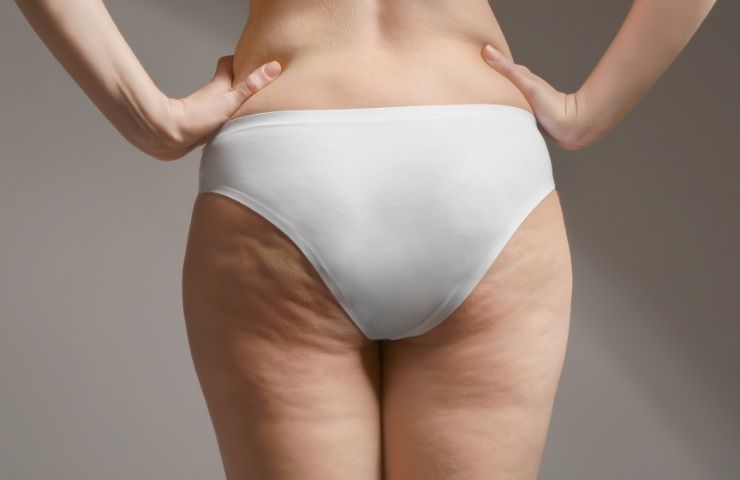 Cellulite e cuscinetti da eliminare