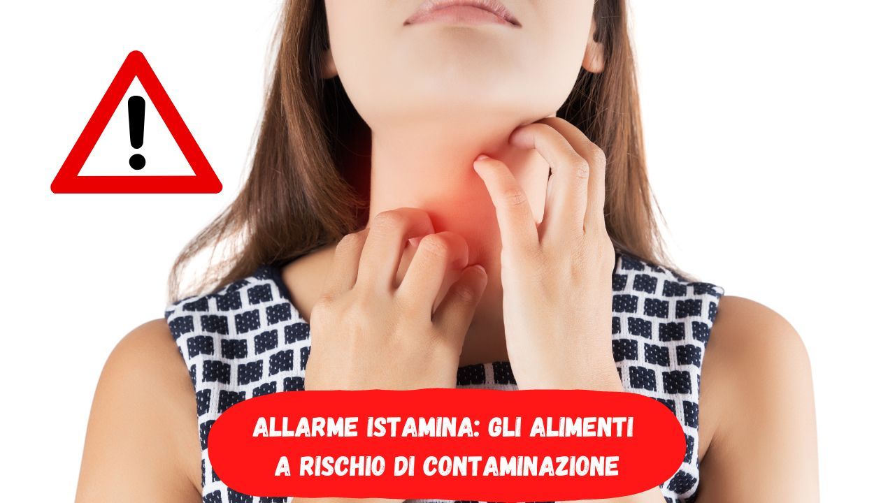 Reazioni avverse cibo contaminato