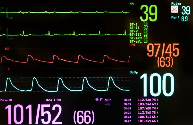 condizione clinica bradicardia