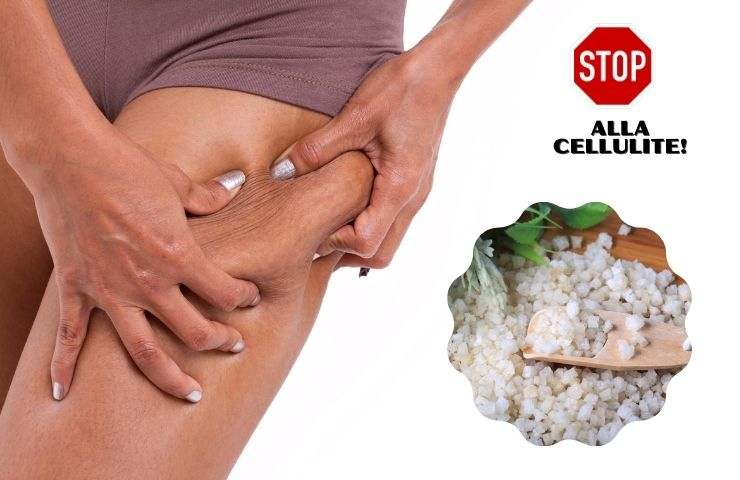 sale cellulite rimedio