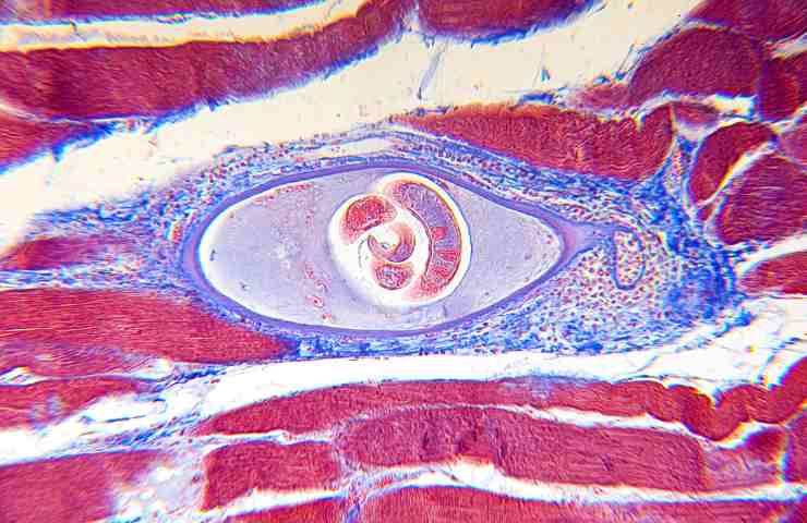 Il parassita della Trichinellosi al miscroscopio