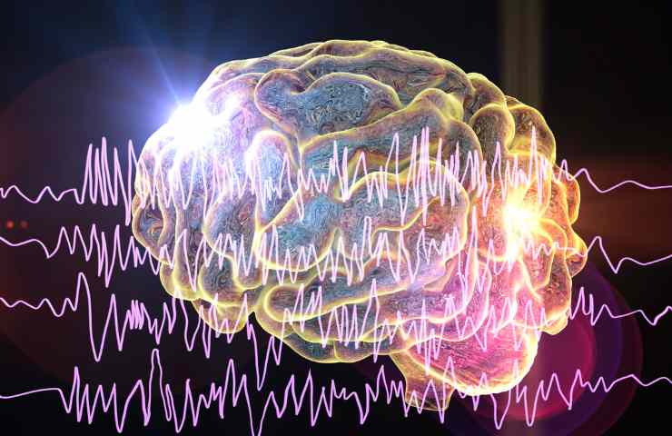 Una rappresentazione del cervello umano in stato di sovraeccitazione