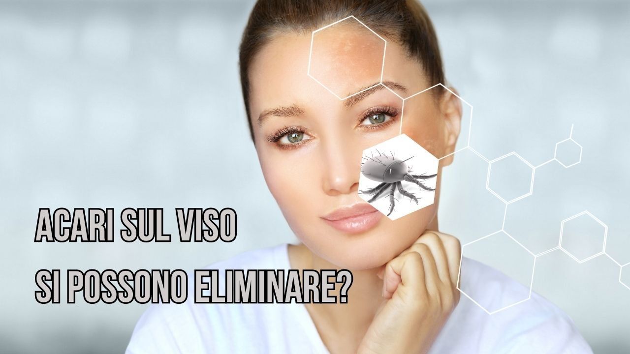 eliminare acari viso