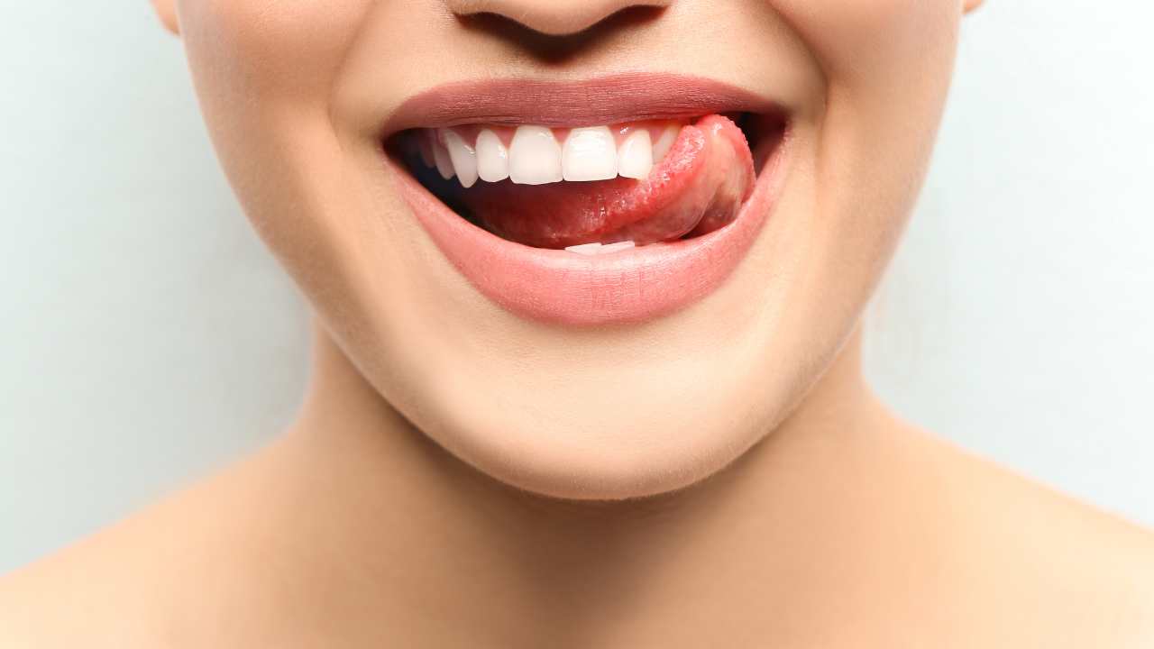 trattamento per denti bianchi come fare a chi rivolgersi sbiancamento