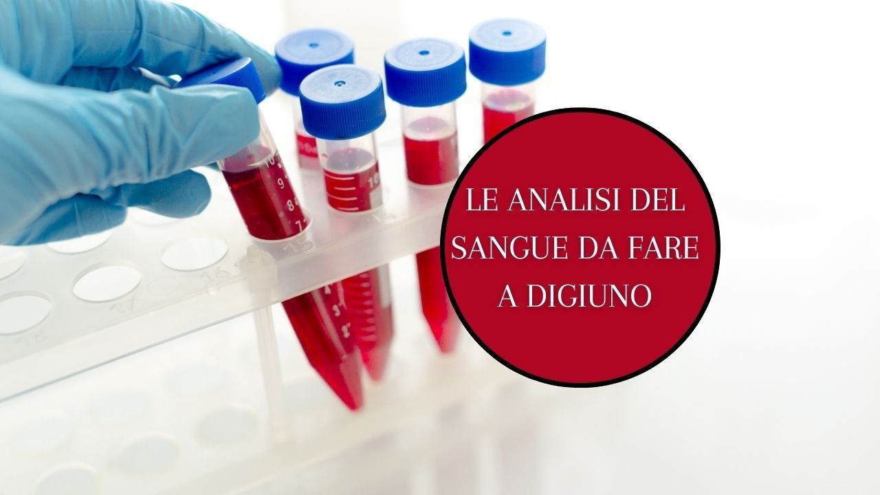 analisi sangue digiuno