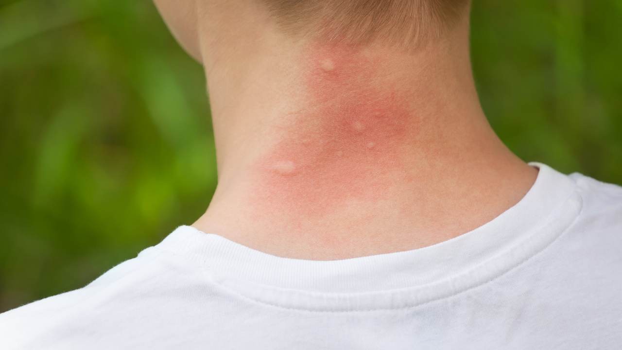 Cosa fare per non farsi pungere dalle zanzare