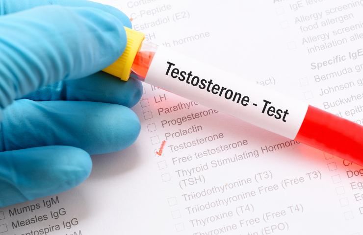 Cosa comporta il testosterone basso negli uomini?