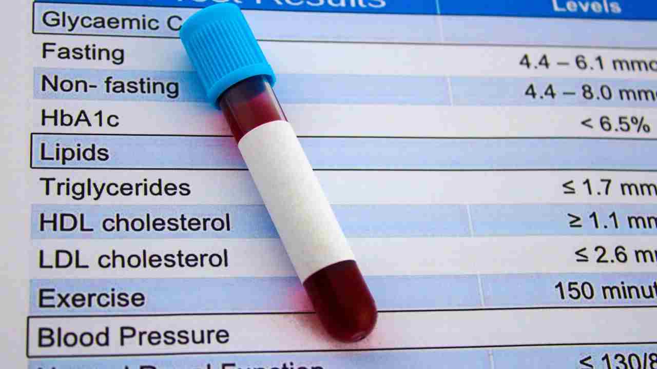 test colesterolo rapido