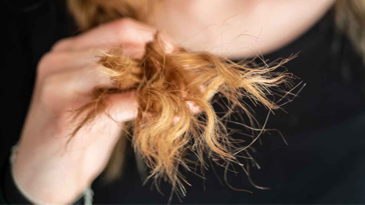 Non lava i capelli da 20 anni e in testa aveva qualcosa di orribile