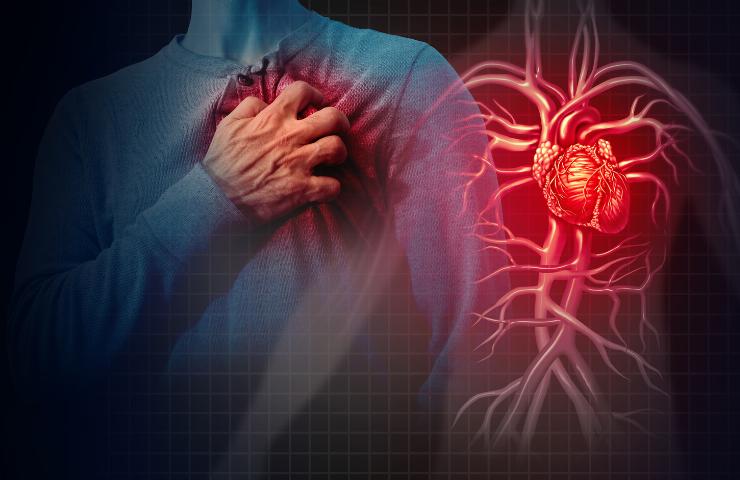 Dolore intercostale ed infarto, come riconoscere i loro sintomi