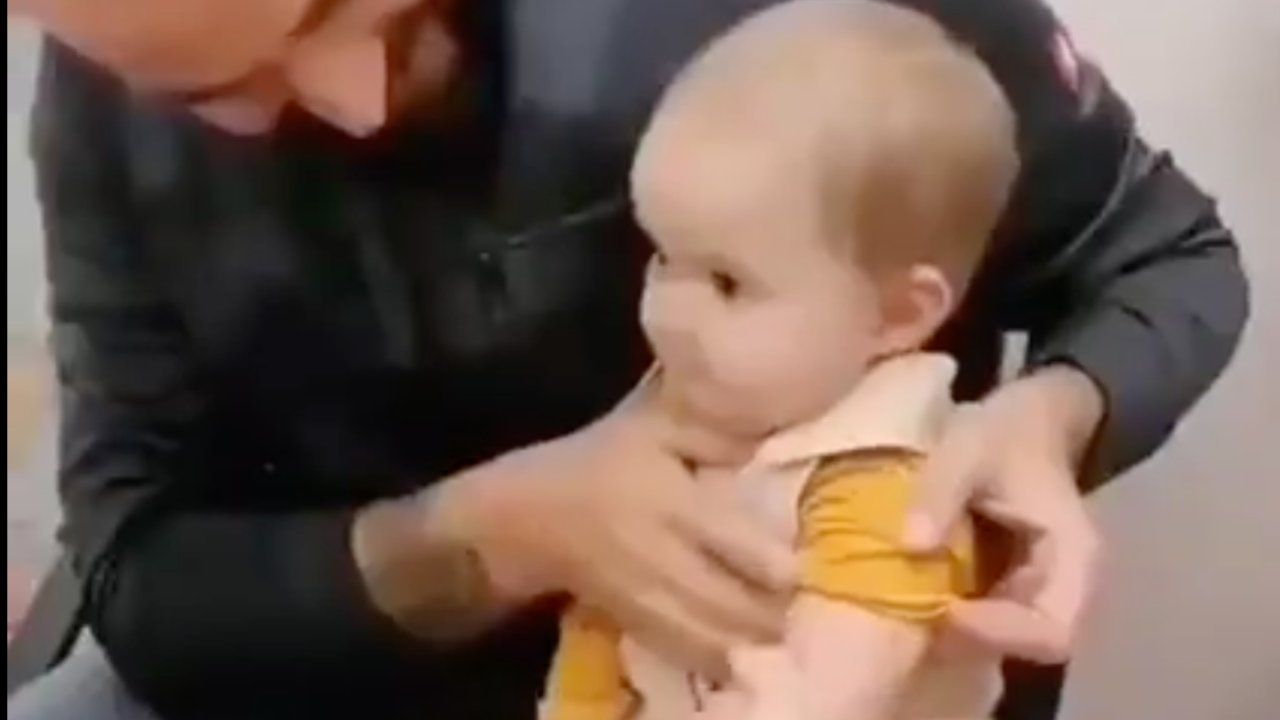 bambina senza braccio espressioni dolci