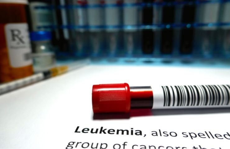 Leucemia cura