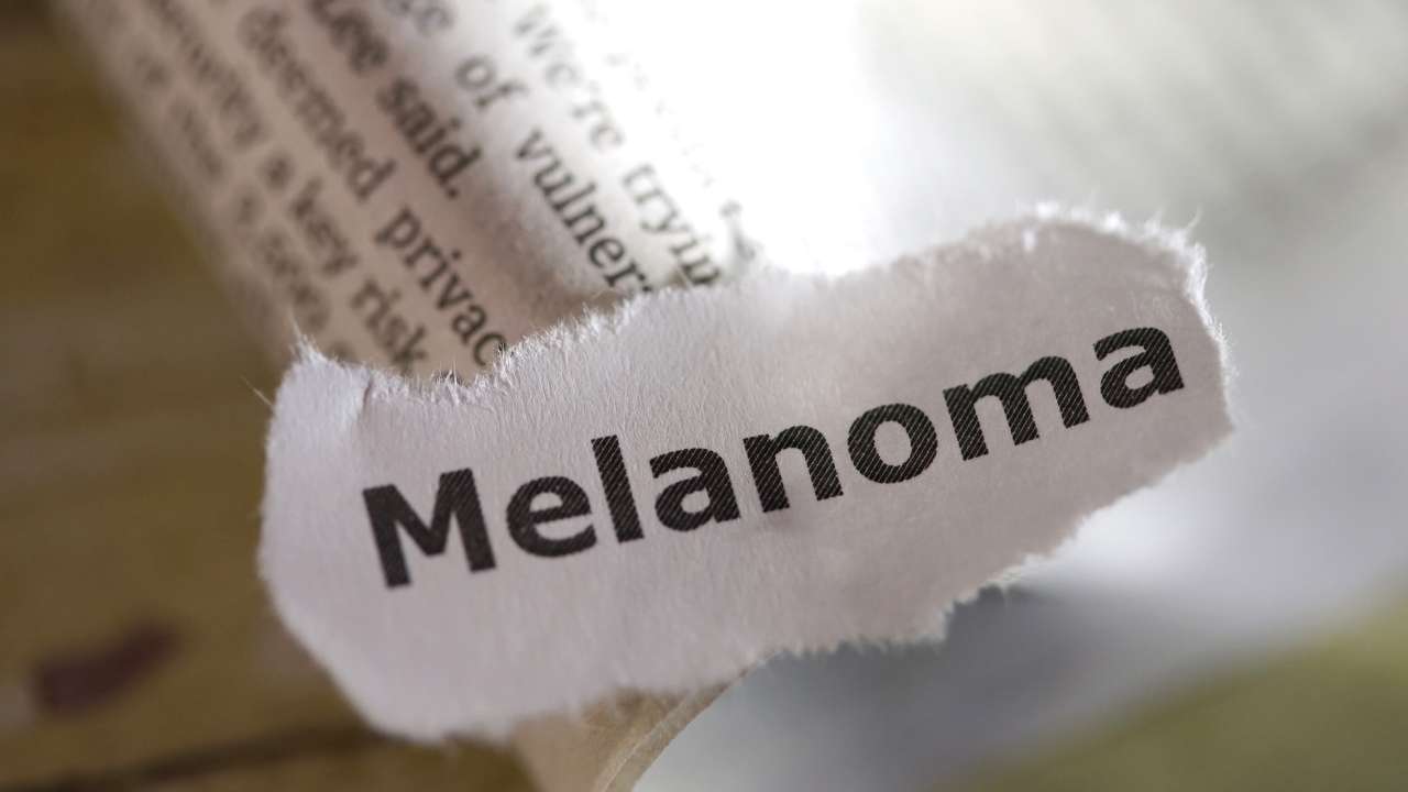 Come evitare un melanoma con l'abbronzatura