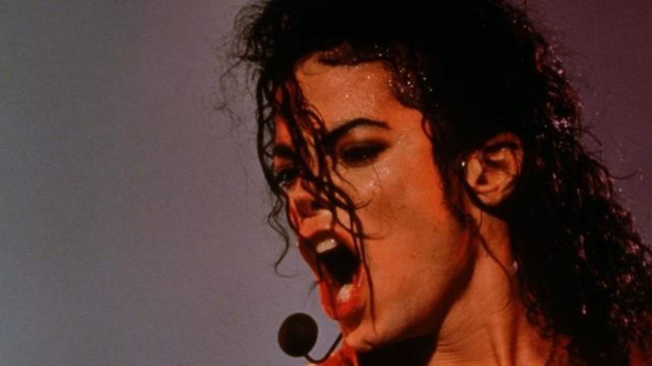 Michael Jackson malattia, che cos'è la vitiligine di cui soffriva