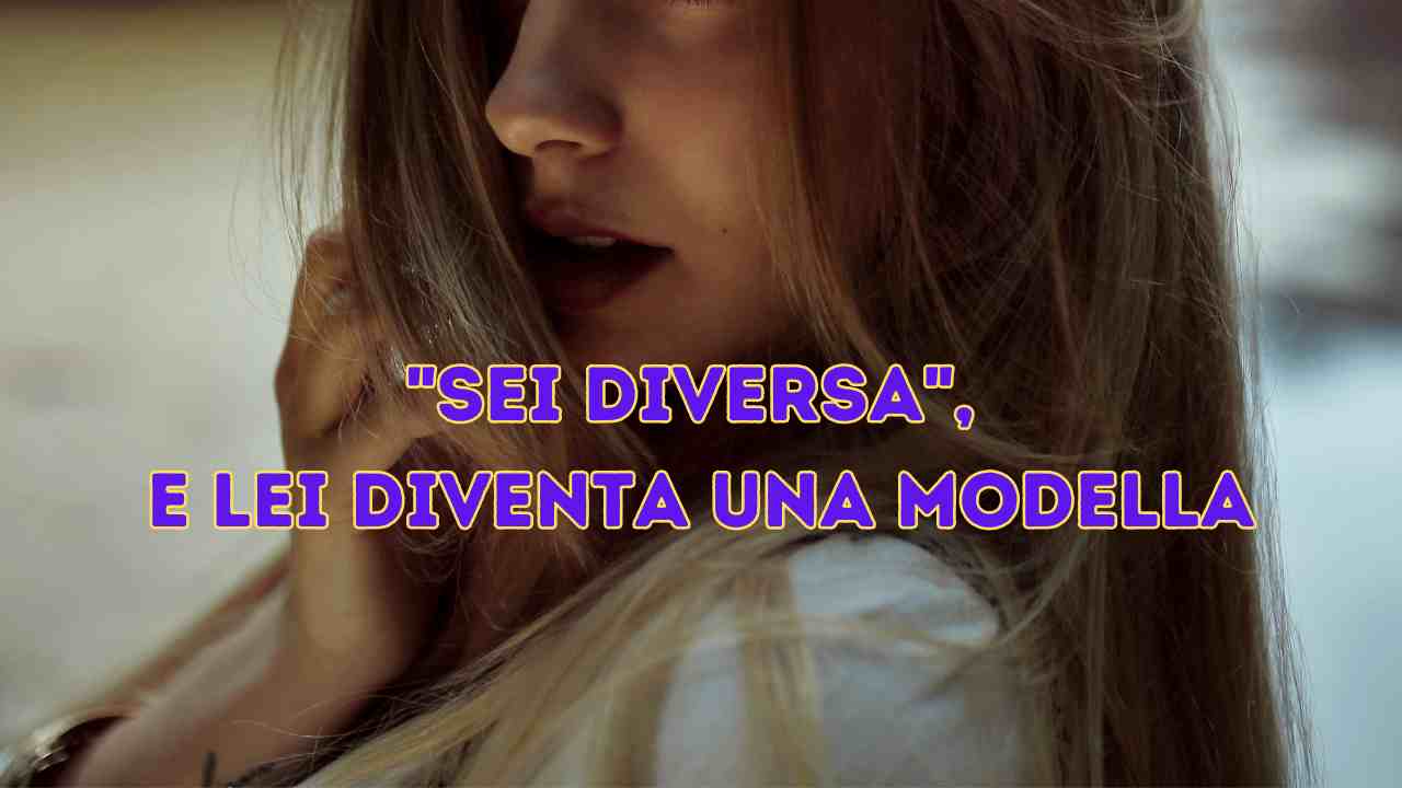 Ragazza diversa diventa modella e dà un insegnamento al mondo