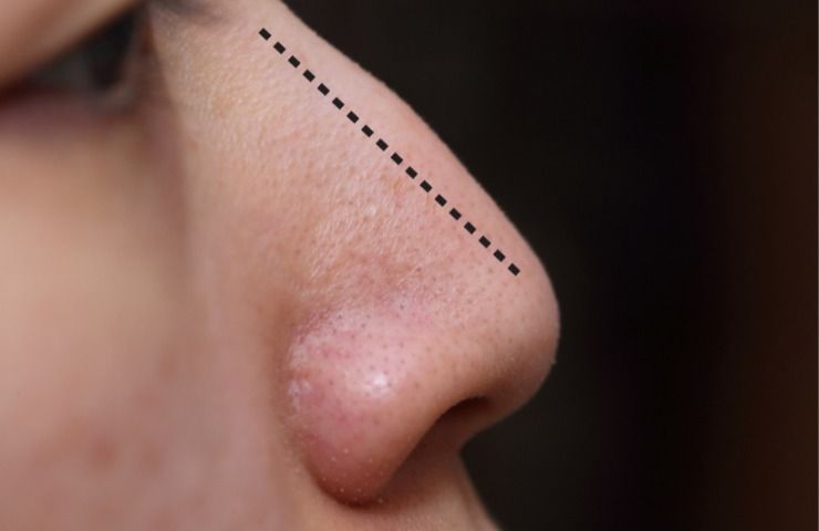 Come hai il naso e cosa dice la sua forma