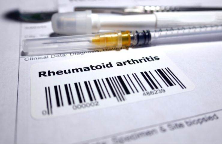 Artrite reumatoide cause