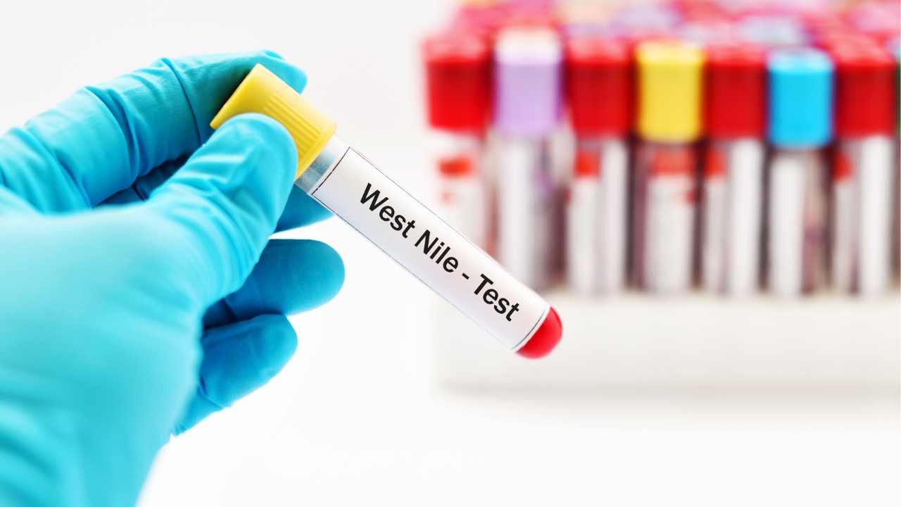 Virus West Nile nuova persona morta in Italia