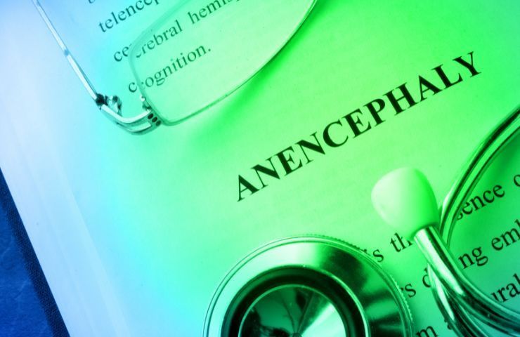anencefalia neonati