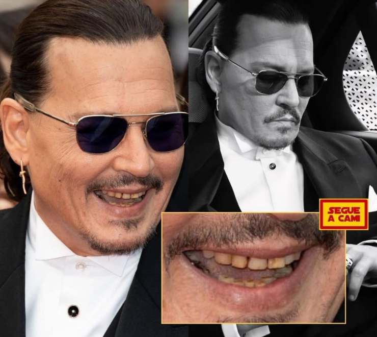 denti marci johnny depp