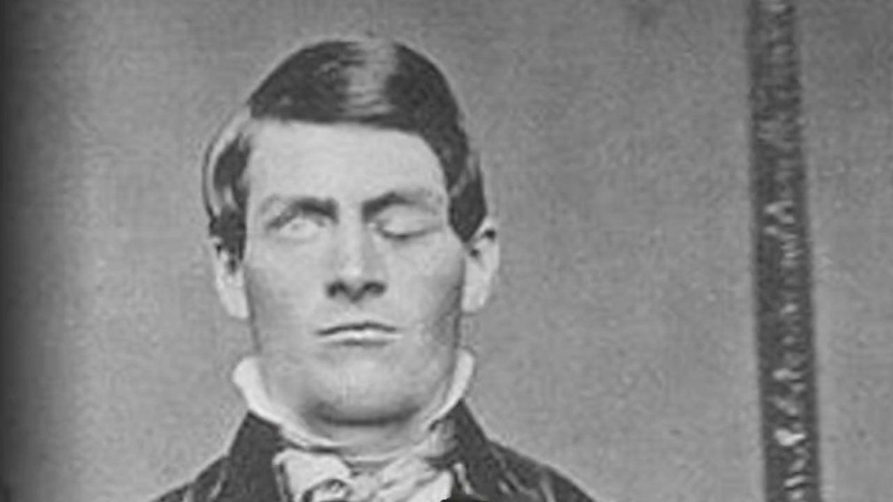 incidente Phineas Gage