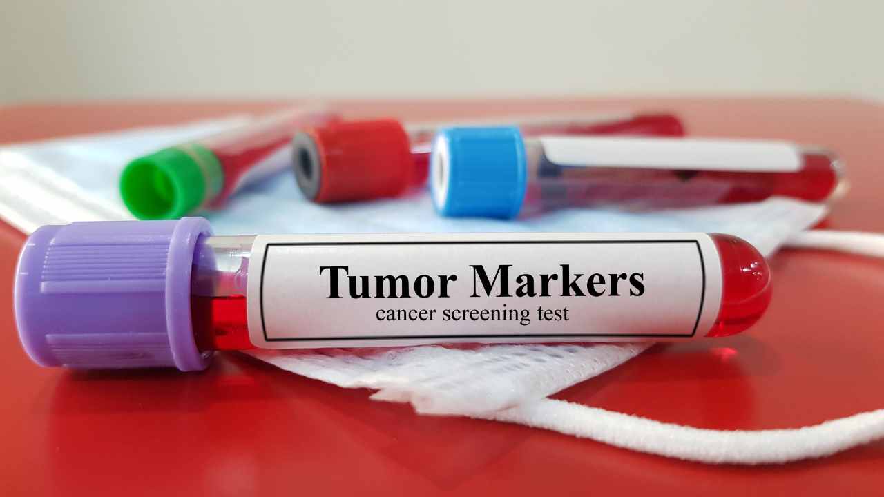 Linfociti T usati per nuovi farmaci anti tumore