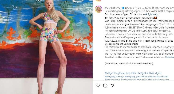 Theresia Fischer storia gambe